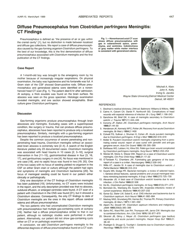 PDF extract preview