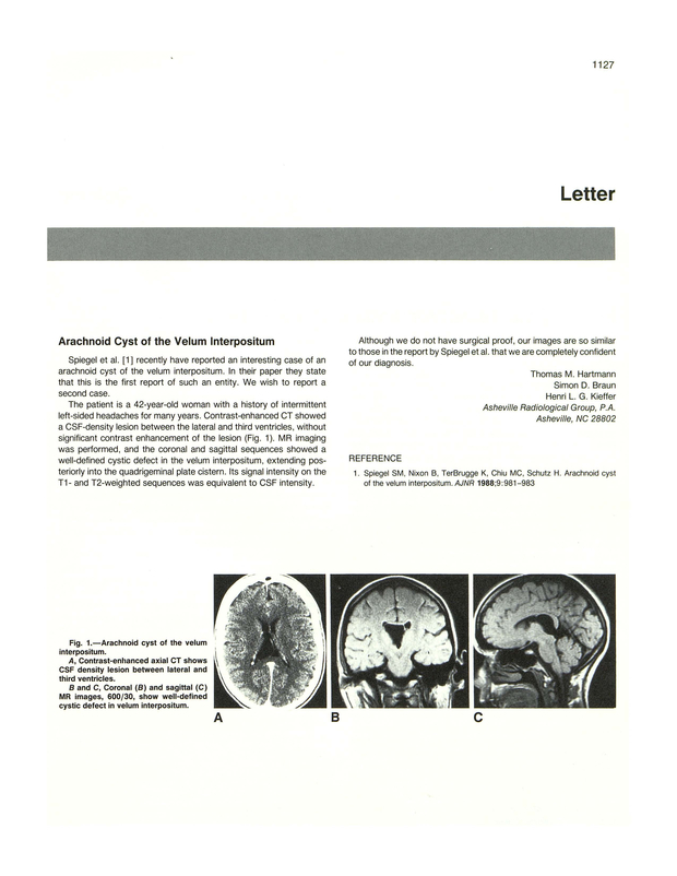 PDF extract preview