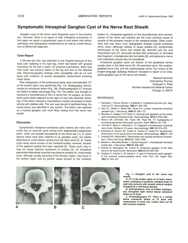 PDF extract preview