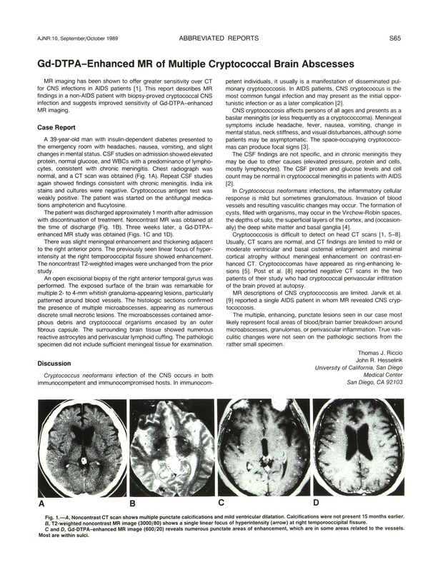 PDF extract preview