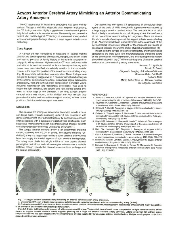 PDF extract preview