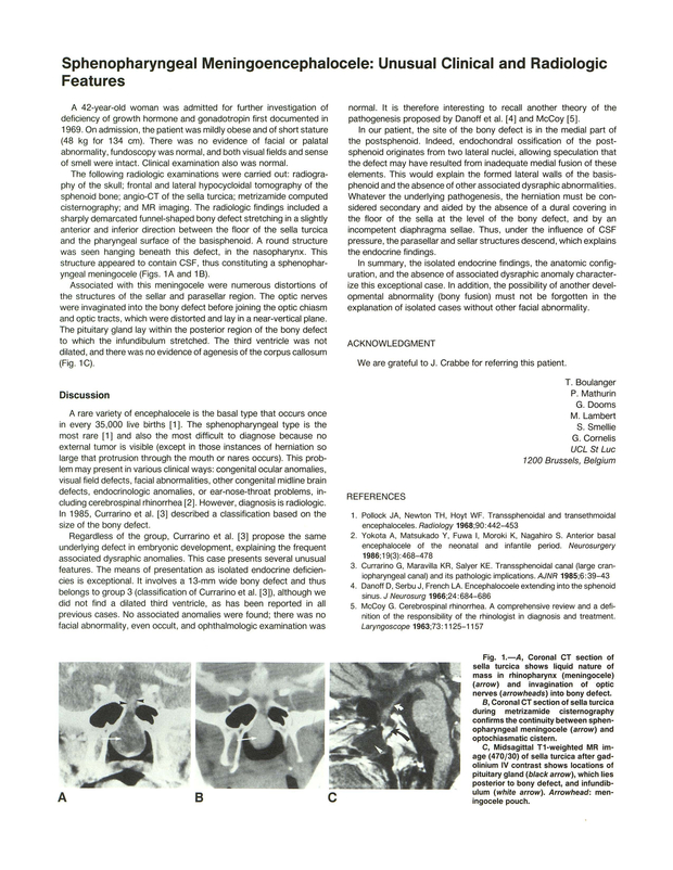 PDF extract preview