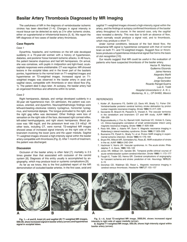 PDF extract preview