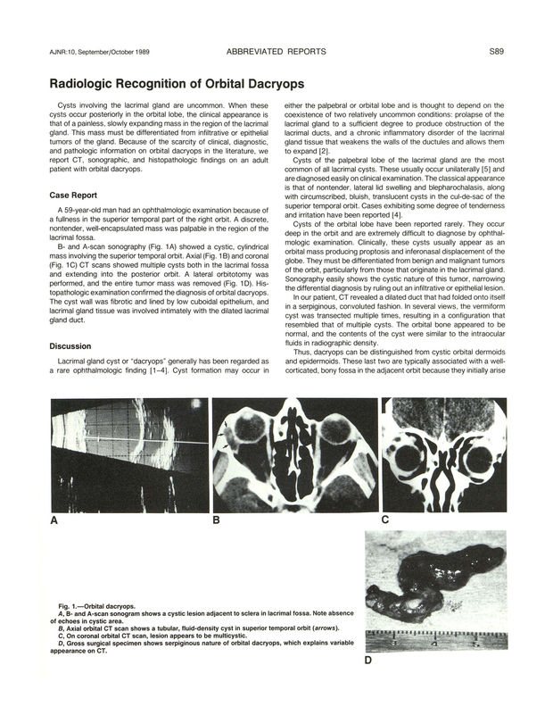 PDF extract preview