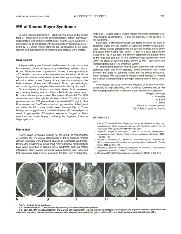 PDF extract preview
