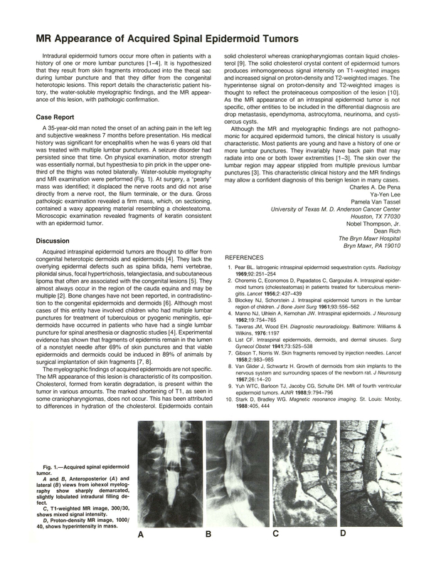 PDF extract preview