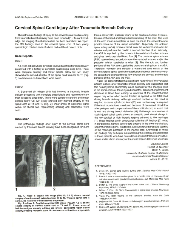 PDF extract preview