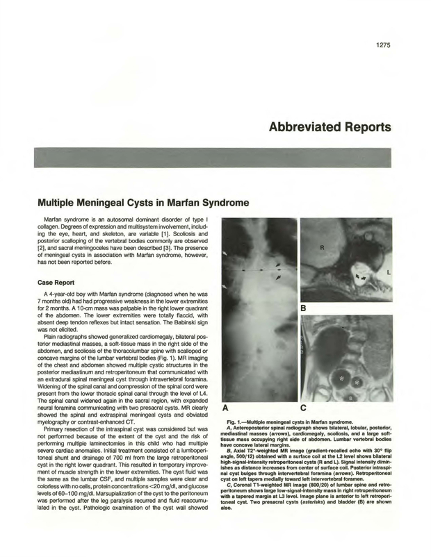 PDF extract preview