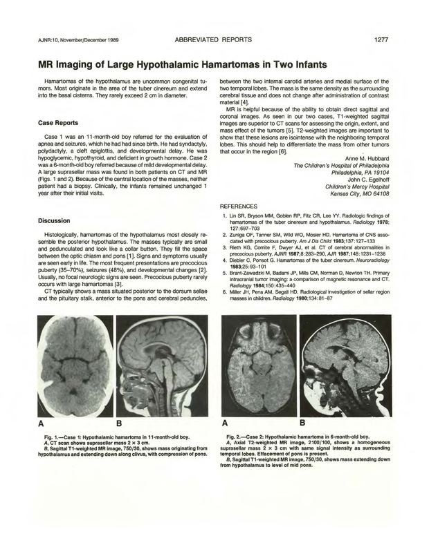 PDF extract preview