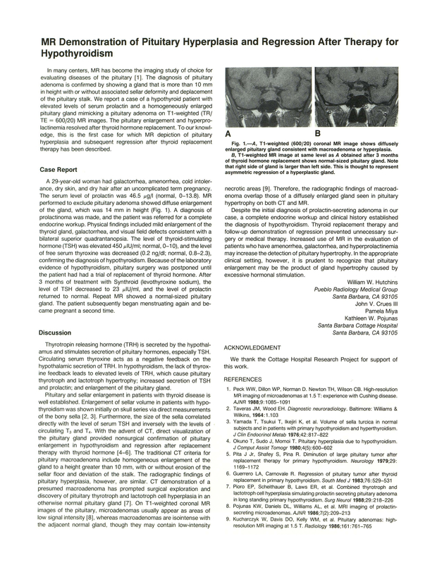 PDF extract preview