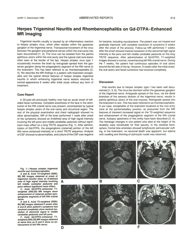 PDF extract preview