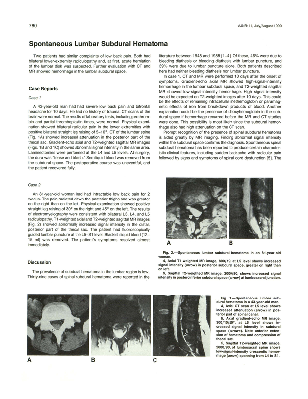 PDF extract preview