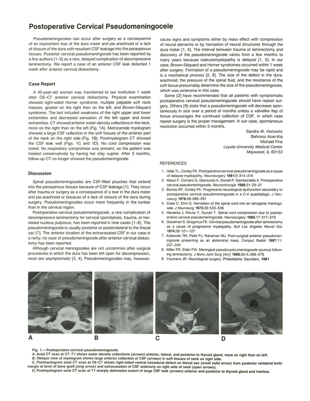 PDF extract preview