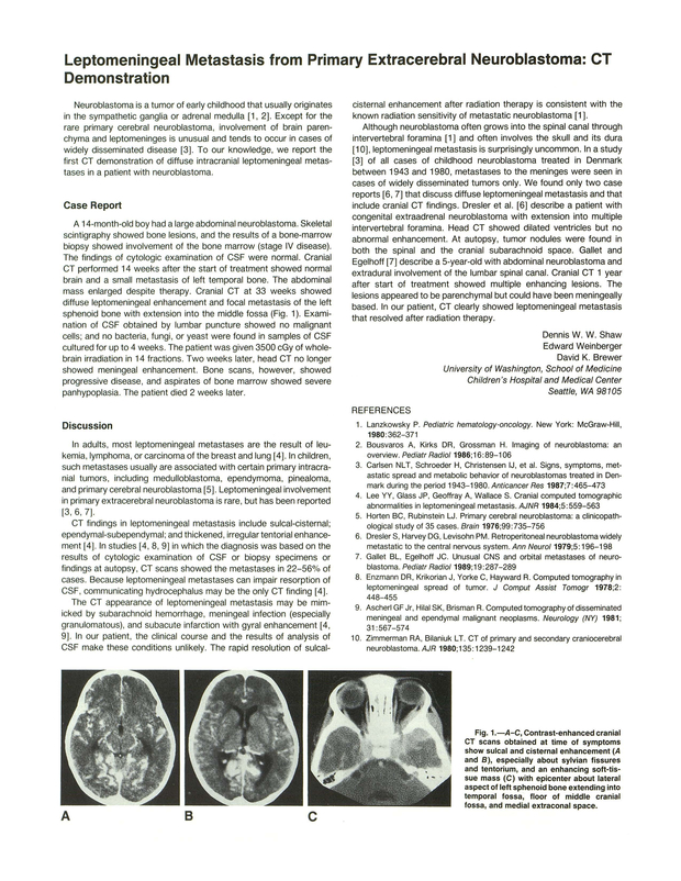 PDF extract preview