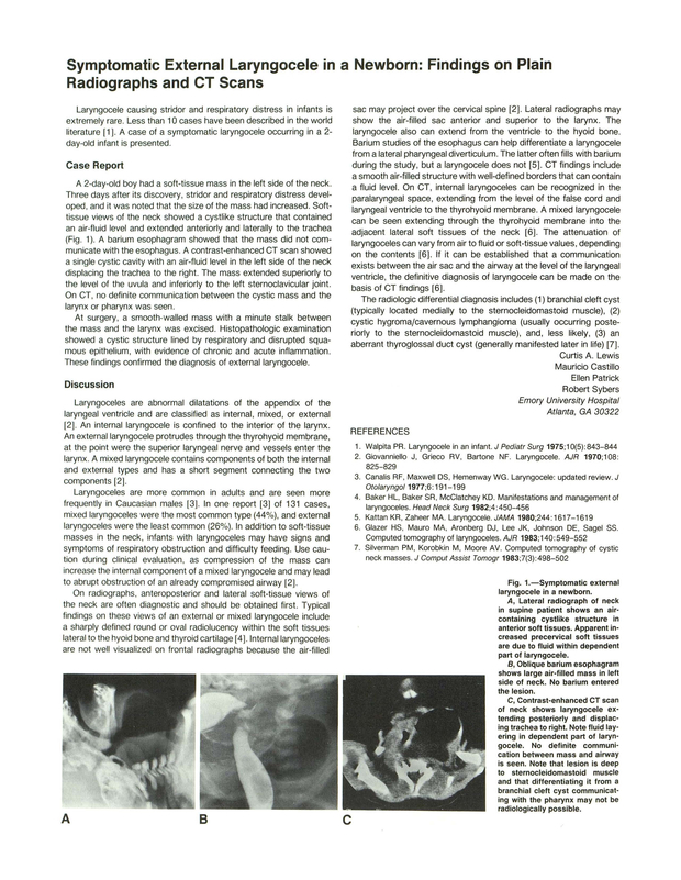 PDF extract preview