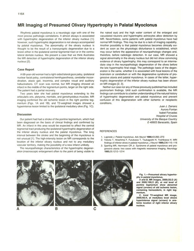 PDF extract preview