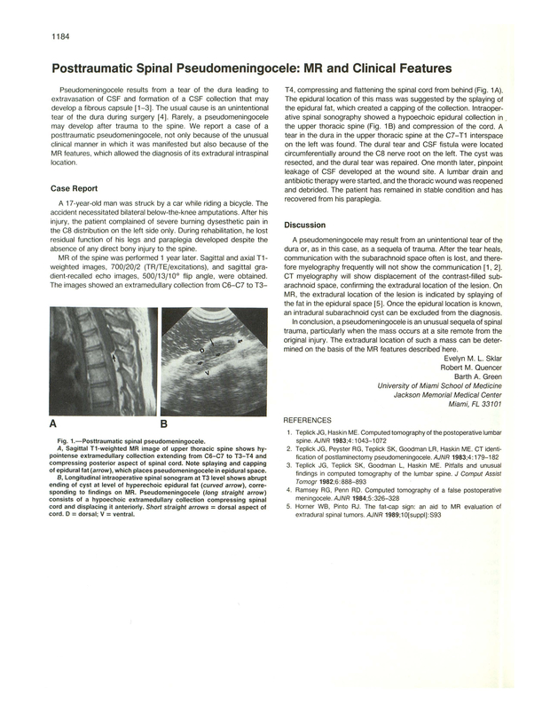 PDF extract preview