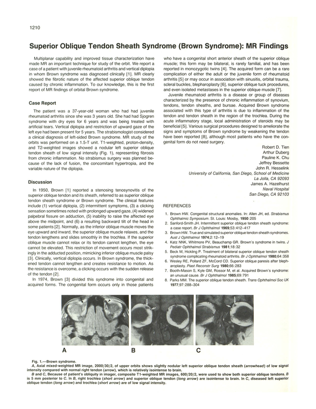 PDF extract preview