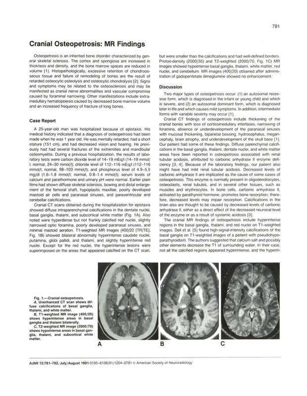 PDF extract preview