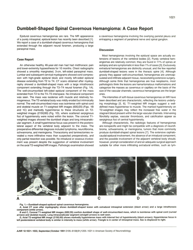 PDF extract preview