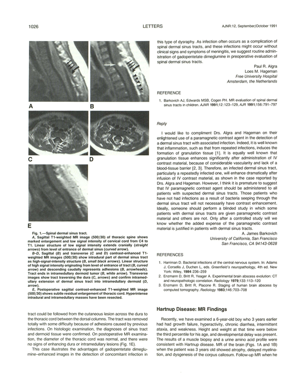 PDF extract preview