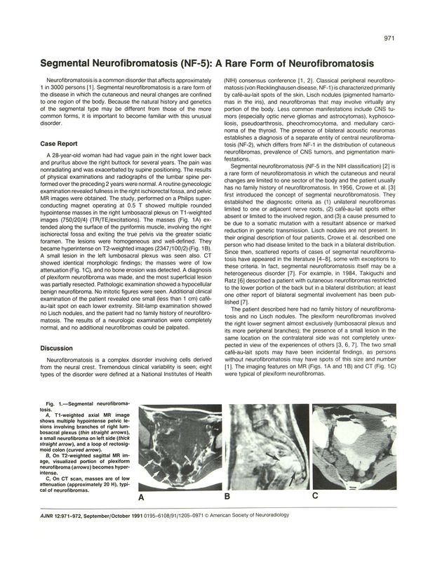 PDF extract preview