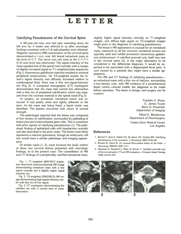 PDF extract preview