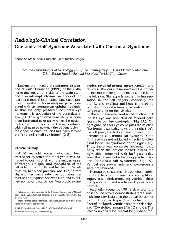 PDF extract preview