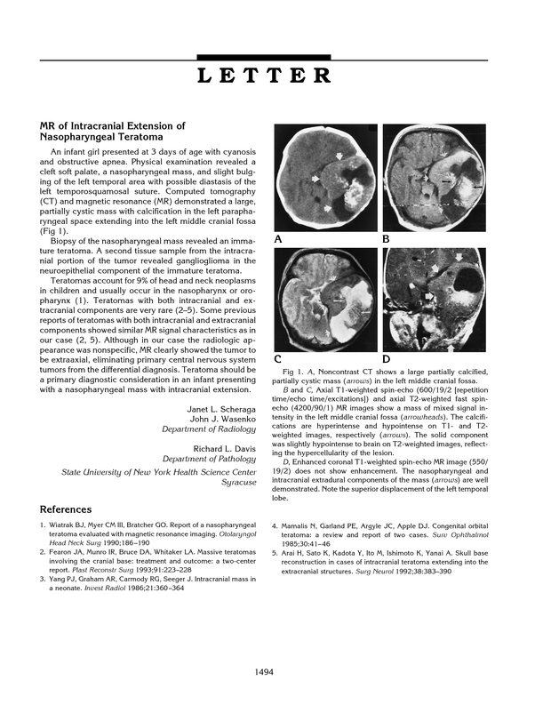 PDF extract preview