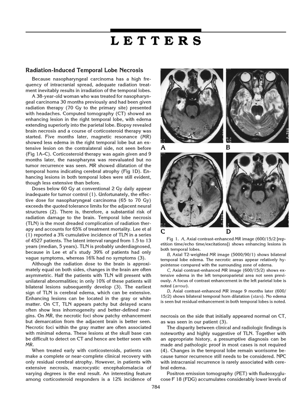 PDF extract preview