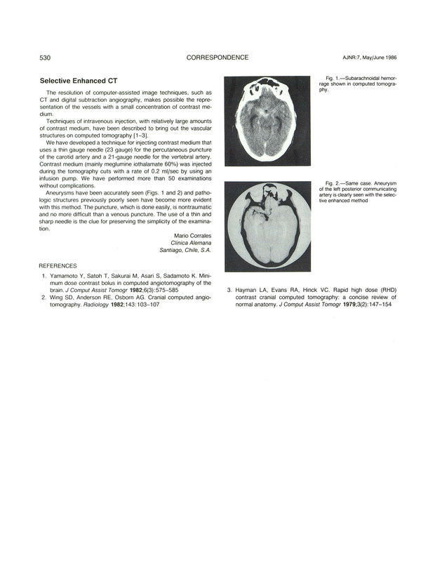 PDF extract preview