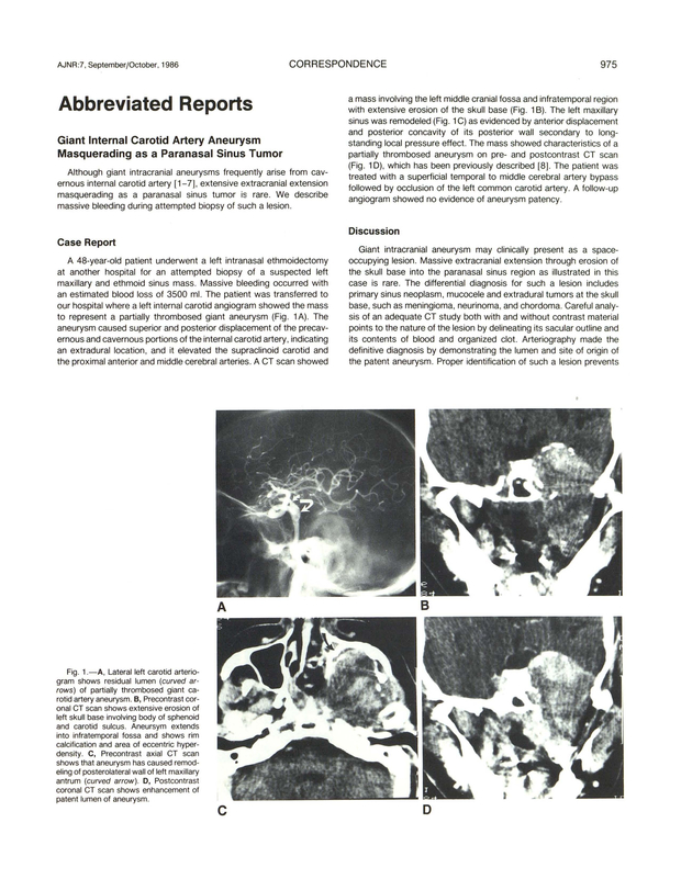 PDF extract preview