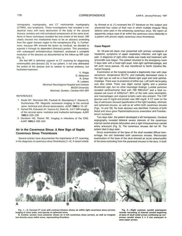 PDF extract preview