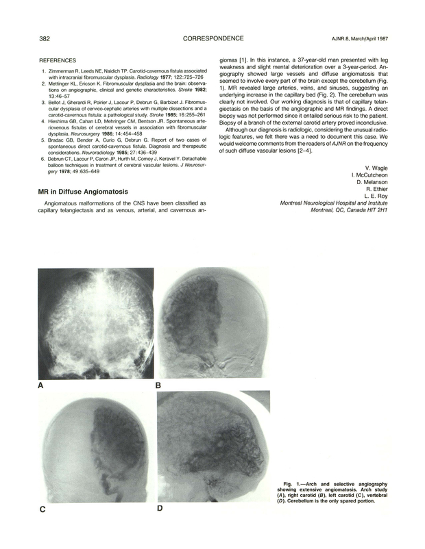 PDF extract preview