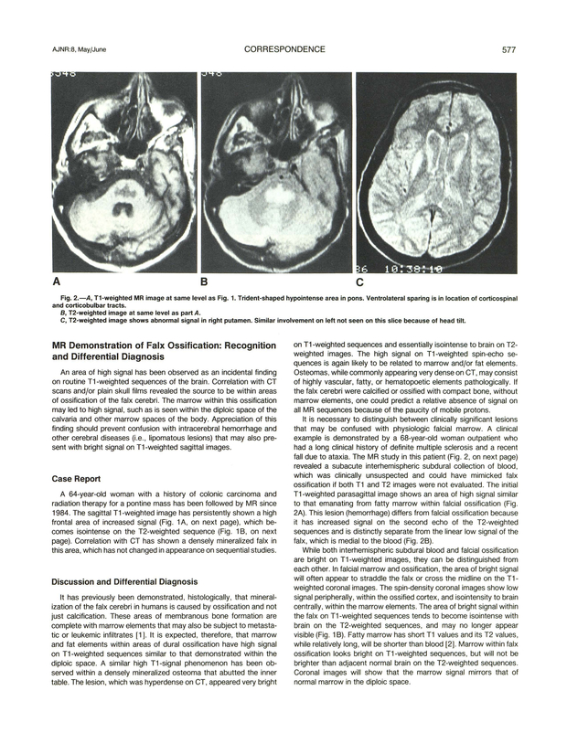 PDF extract preview