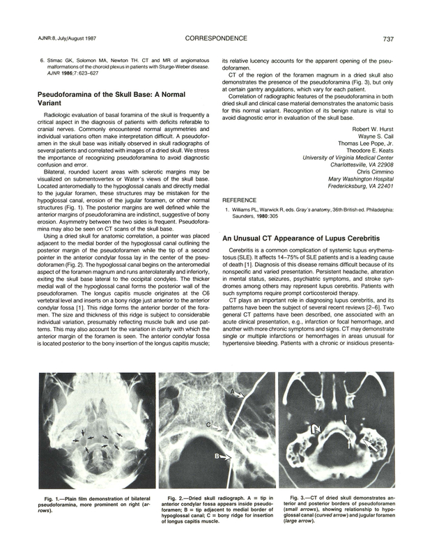 PDF extract preview