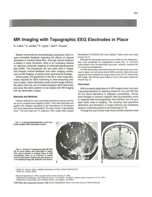 PDF extract preview
