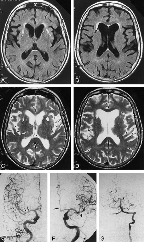 fig 4.