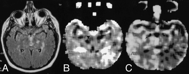 Figure1