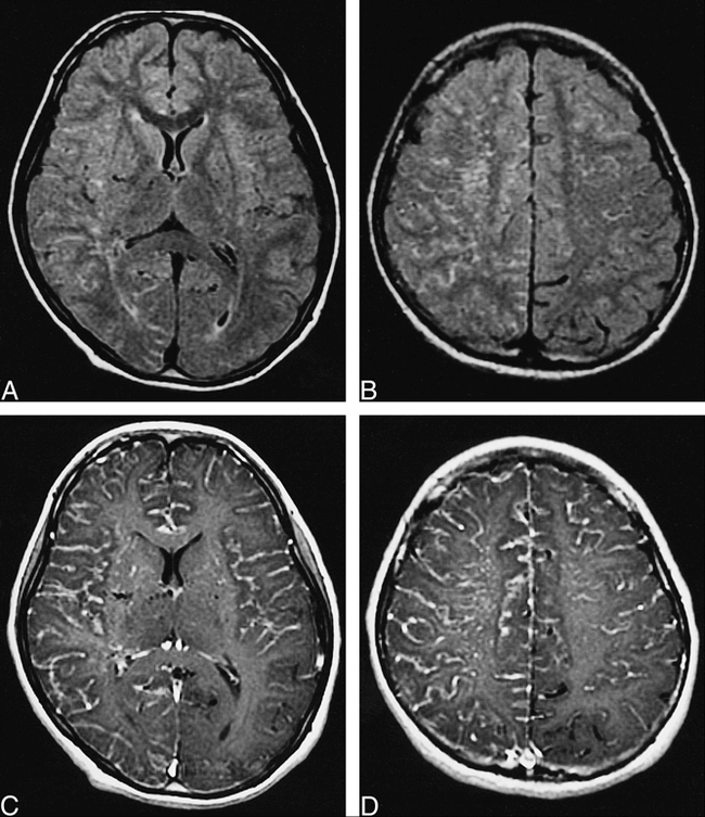fig 1.