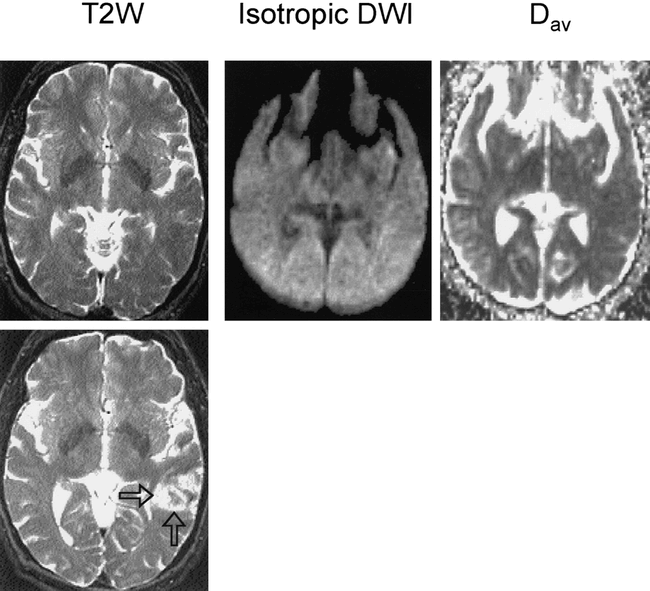 fig 1.