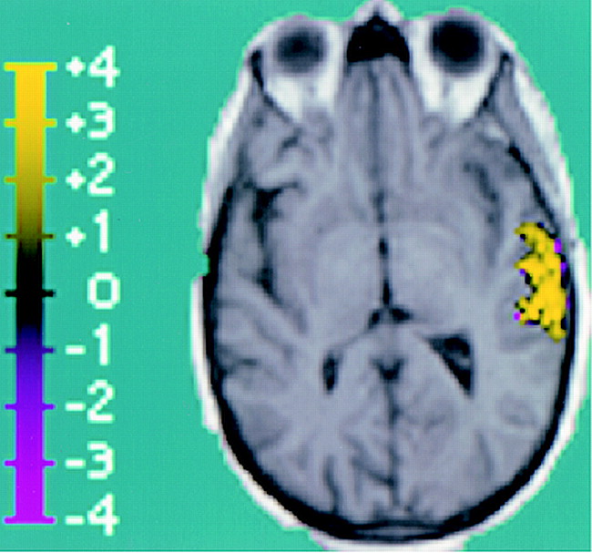 fig 2.