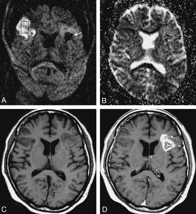 fig 2.