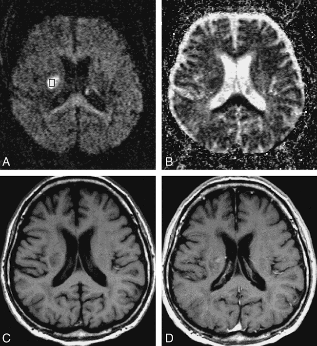 fig 3.