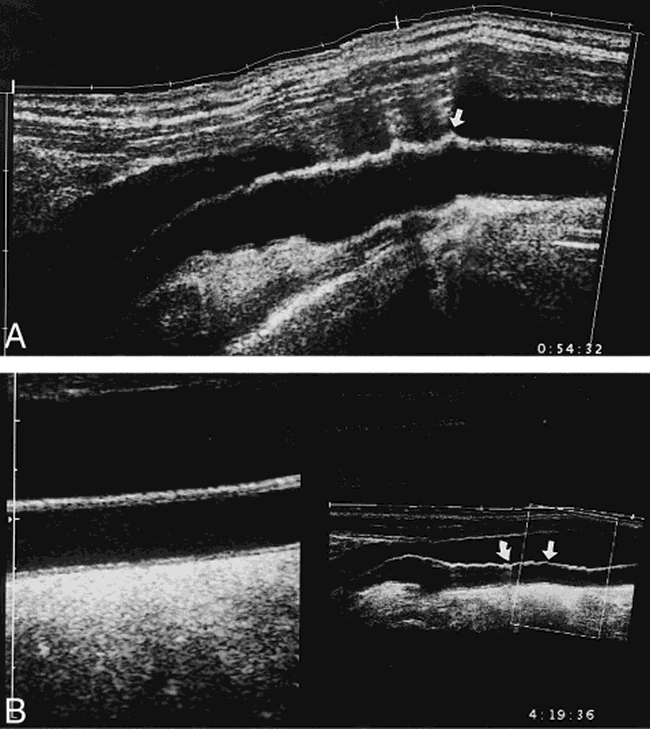 fig 3.
