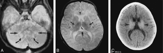 fig 3.