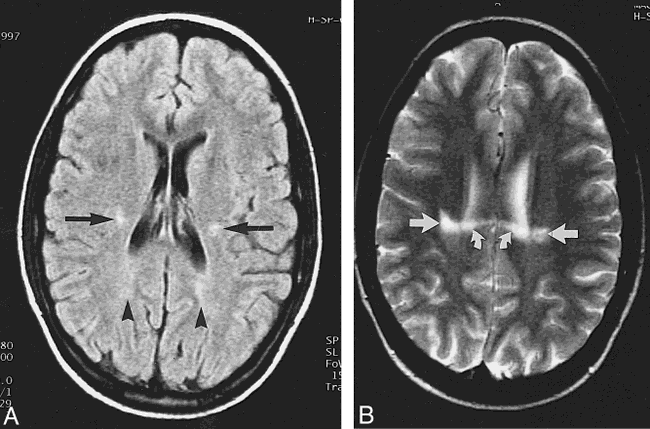 fig 4.