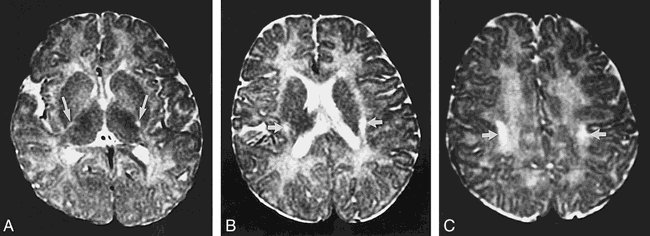 fig 5.