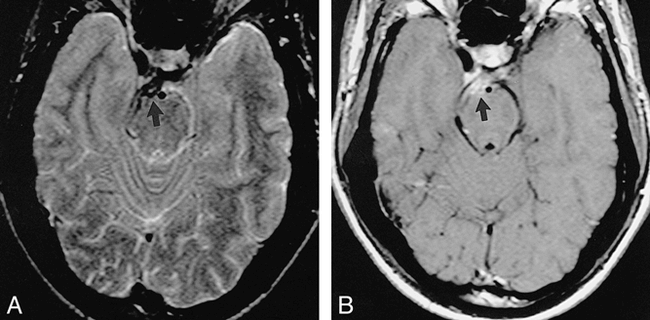 fig 6.