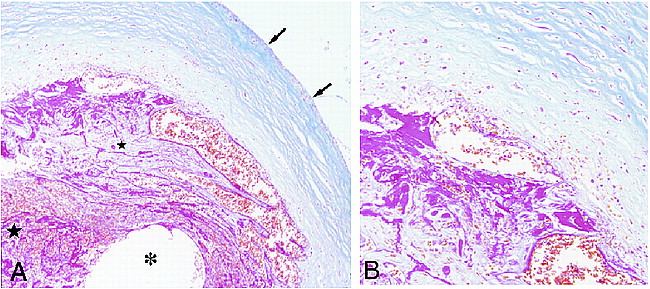 fig 2.